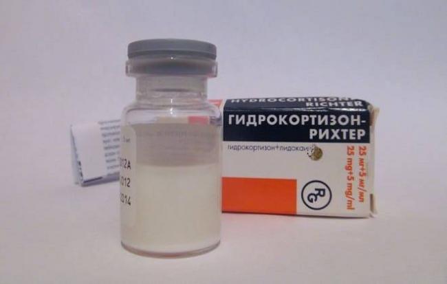 Какие уколы при радикулите поясничном отделе позвоночника