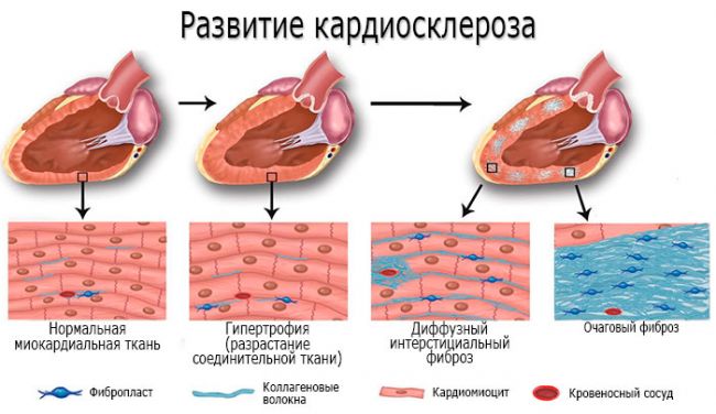 причины, признаки, симптомы и лечение