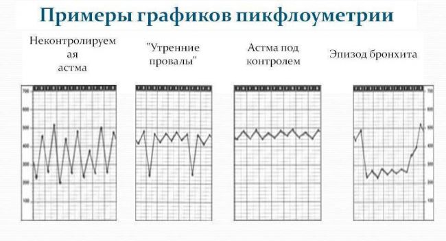 Спирометрия при бронхиальной астме