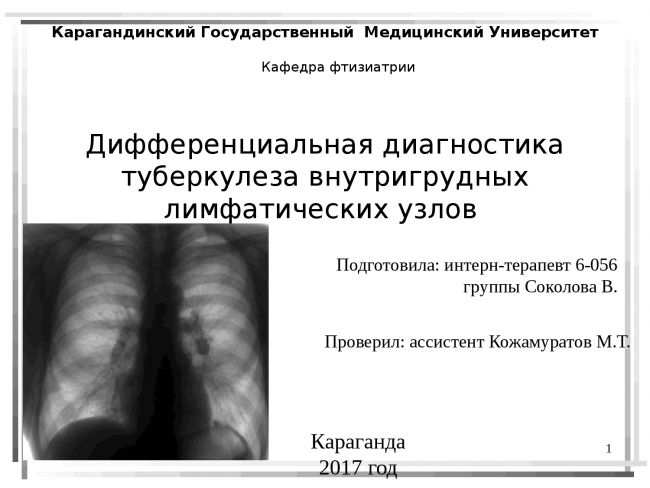 Туберкулез внутригрудных лимфатических узлов