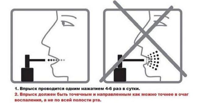 Раствор люголя с глицерином инструкция по применению