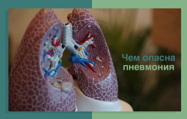 Чего ждать от пневмонии у лежачих больных? кто входит в группу риска?
