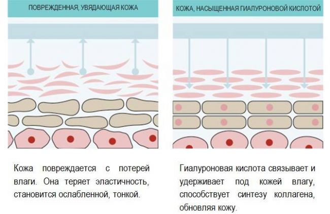 Таблетки, крем, инъекции Гиалуроновой кислоты: для лица, увеличение губ, отзывы, цена в аптеке