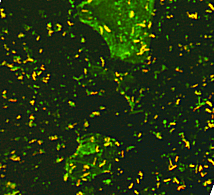 Микобактерия туберкулёза (mycobacterium tuberculosis)