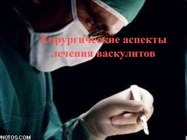 Болезнь бюргера