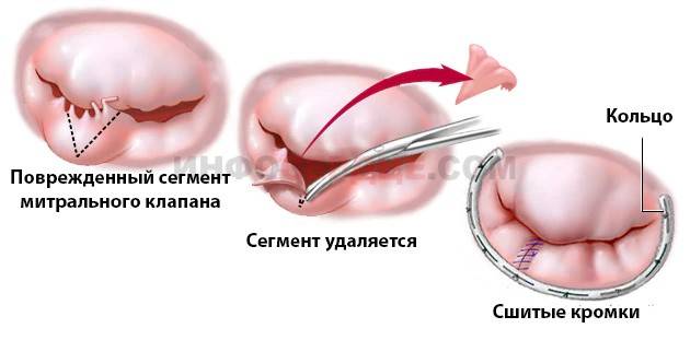 Клиническая эхокардиография