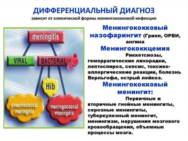Назофарингит