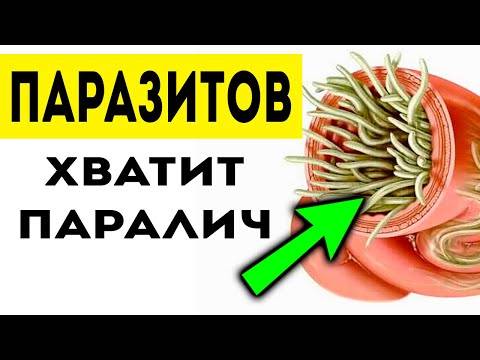 Принципы диеты при лечении глистов у взрослых и детей