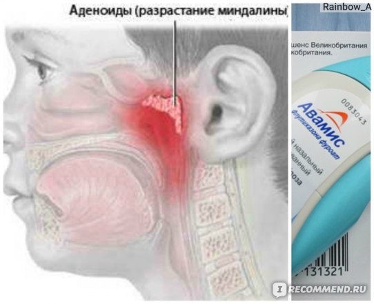 Авамис инструкция по применению и аналоги авамис