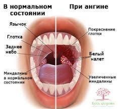 Психосоматика кашля у детей и взрослых