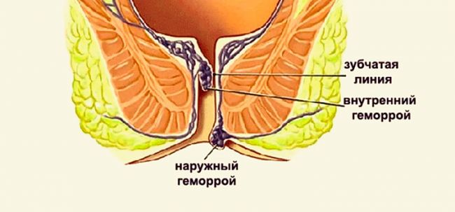 Аналог свечей синтомицин