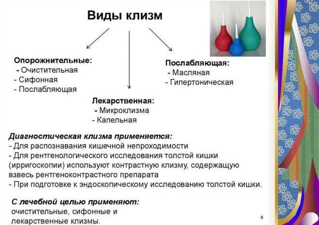 Клизма при запоре
