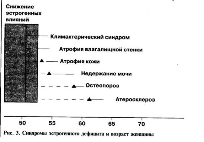 Менопаузальный синдром (менопауза)