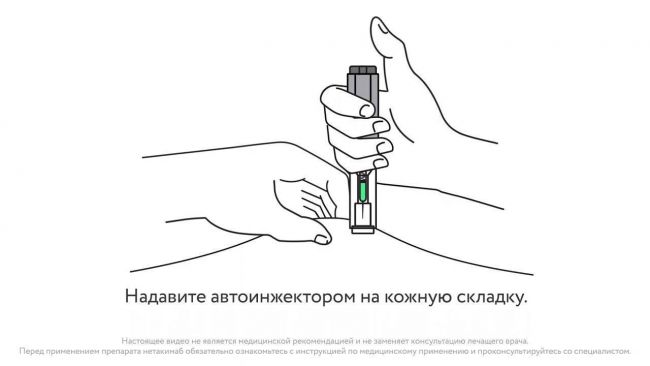 Классификация туберкулеза легких: какие формы и виды бывают?
