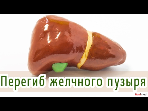 Перегиб или загиб желчного пузыря у ребенка