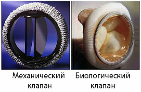 Клиническая эхокардиография