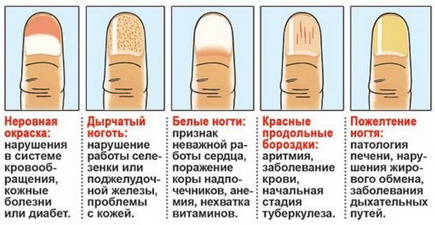 Изменился цвет ногтей на руках