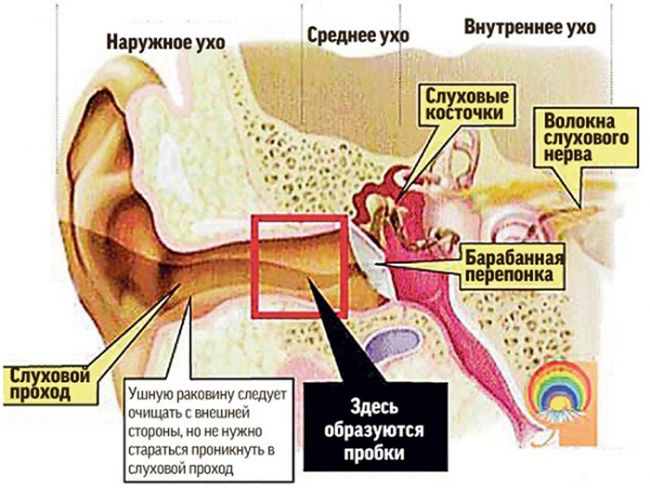 Лучшее средство от шума в голове
