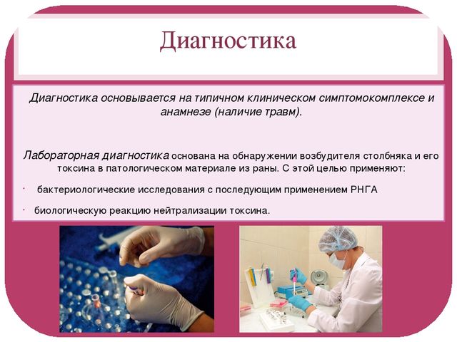 Столбняк