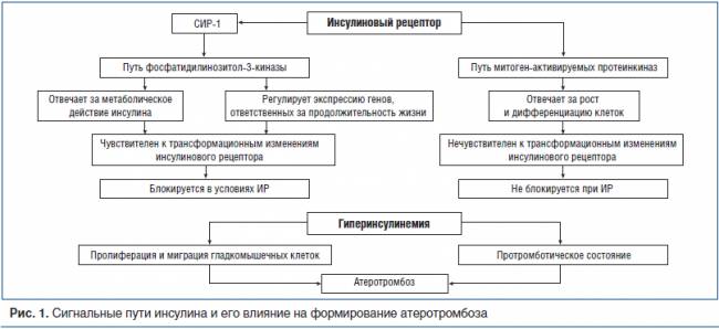 Особенности течения туберкулеза при сахарном диабете