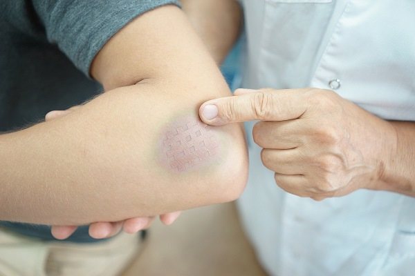 Мазь арника: описание, лечебные свойства и применение
