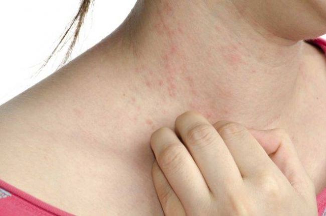 Глюкоза раствор инструкция по применению