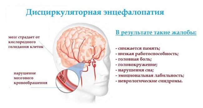 Энцефалопатия головного мозга: что это такое и как лечить — спросиврача