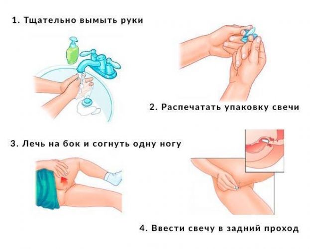 Свечи с метилурацилом при геморрое применение и инструкция