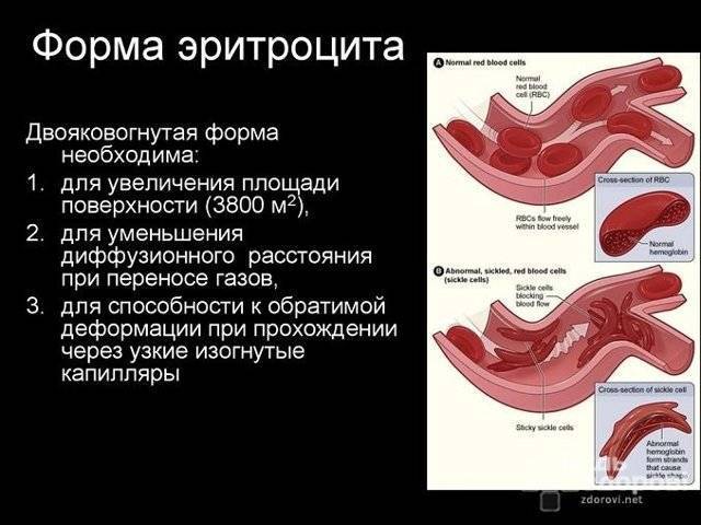Какой бывает мокрота при туберкулезе легких?