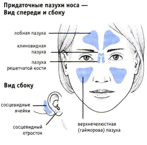 Как вылечить гайморит без прокола в домашних условиях