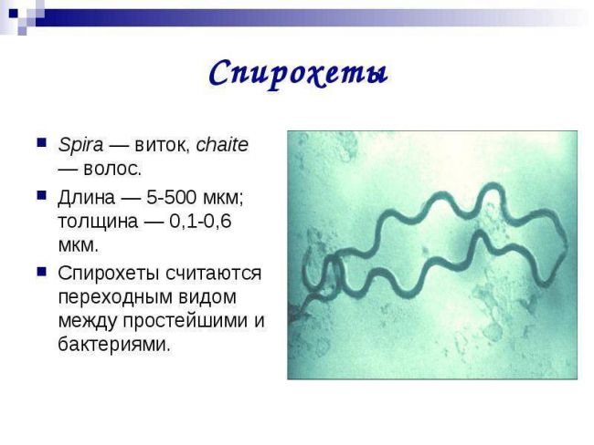 Почему бактерии относят к примитивной форме жизни и чем они отличаются от растений других организмов?