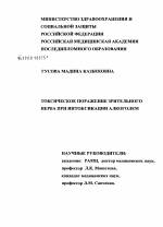 Зрачки наркомана: как определить зависимость по глазам