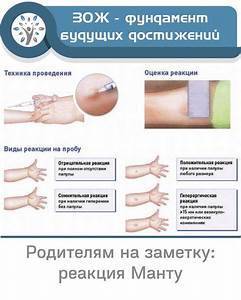 Какая должна быть реакция манту: норма у детей и взрослых