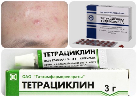 Мазь глазная "тетрациклин" отзывы