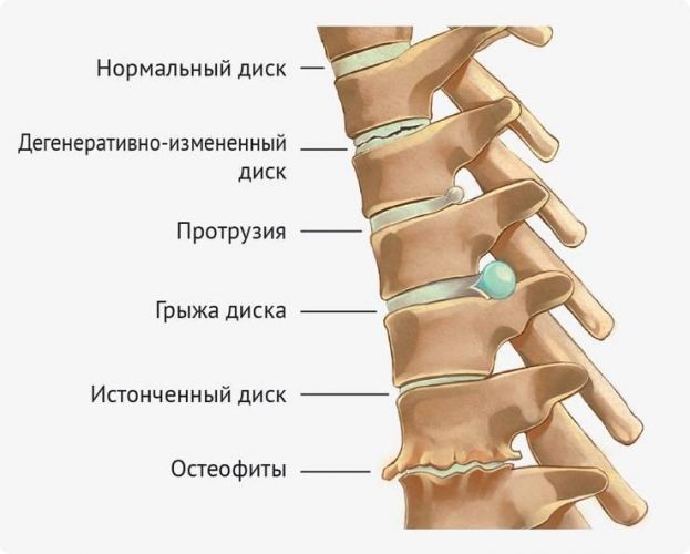 За что отвечает каждый позвонок шейного отдела позвоночника