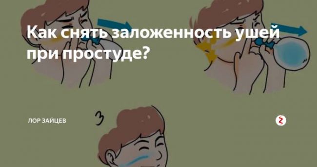Заложенность уха (ушей). причины, симптомы и признаки заложенности одного или обоих ушей