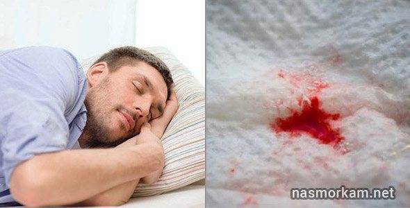Причины прожилок крови в слюне