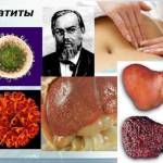 Боли в правом подреберье, что это может быть?